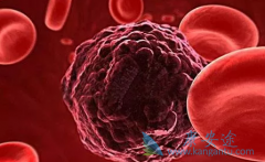 ����ҽ�ƵĻ��߶��ڻ���û����ô�ų�