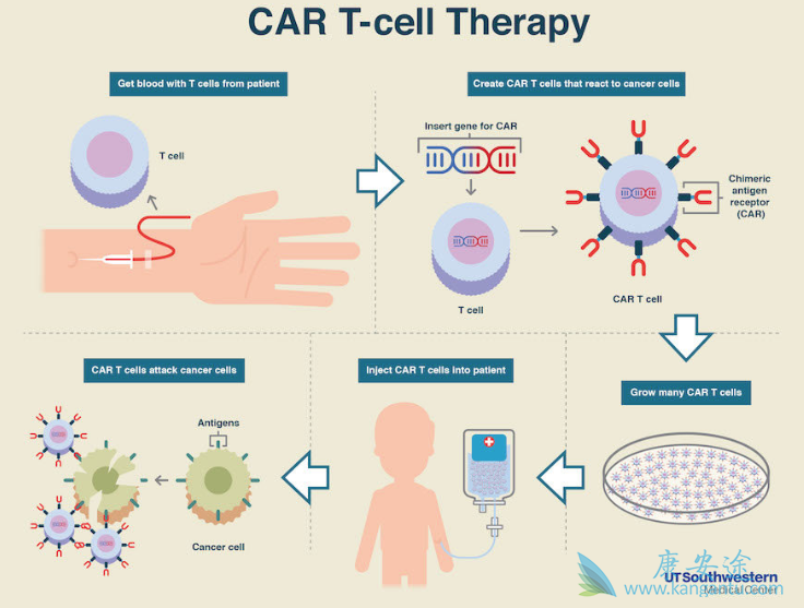 CAR-T