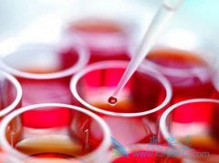 ����ҽ�Ƴ�δ���򵥵�Ѫ��Ҳ��׼ȷ�����֢