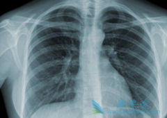 ��������ַΰ�����֢״������Ҫ����