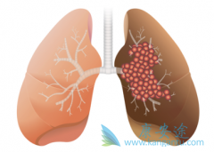 �ΰ����ڻ��ܻ�������Щ������Ӱ��