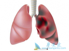 �ΰ�����֢״�������Щ�û��ߵ��ĵ����