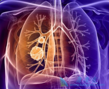 �ΰ�������ʲô֢״��������Ʒΰ�