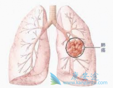 �ΰ����ڴ�Ⱦ��������Щ���ؾ�����