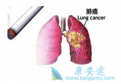 �ΰ����ڿ����κ����ǻ��߷ǳ���ע������