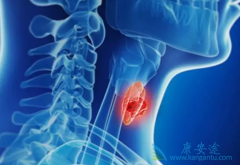 ��������(Vandetanib)�޸�MTC���ߵļ�����֯��Ҫ�೤ʱ��