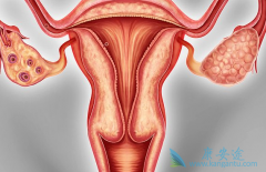 ��������(Olaparib)Ƭ���ɳ�������BRCAͻ����ѳ������ߵ�PFS