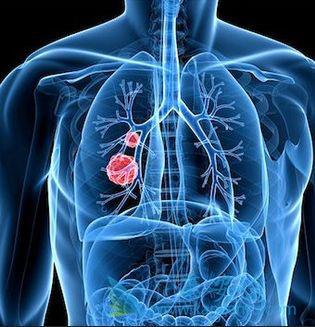 海外医疗 海外医疗