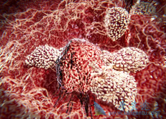 ��Ȭ��(keytruda)������ε�����ʲô�������ͣ��keytruda��