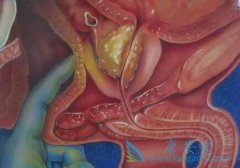 ������ʳ�������˶���Ԥ��ǰ���ٰ�֢����Ч�ֶ�