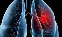 �ΰ���ת�Ʒ����������������Ʋ����ӳ�������