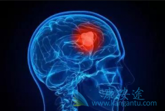 ��������/����������WBRT����EGFEͻ����ת�ƻ��߶�������