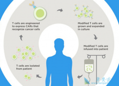 ȫ�µ�CAR-T������ע��ʽ����������ʵ��������