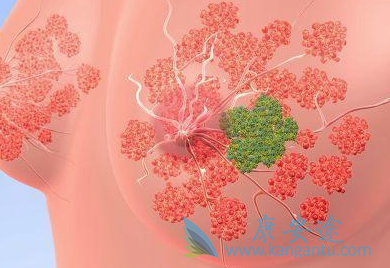 乳腺癌内分泌治疗 乳腺癌内分泌治疗