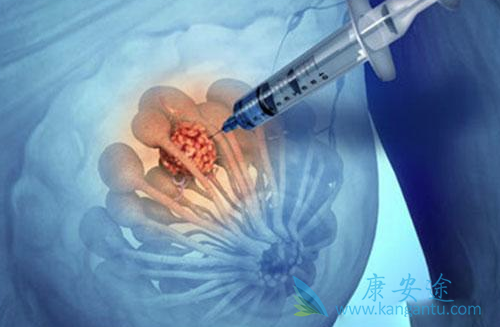 ���ٰ�����