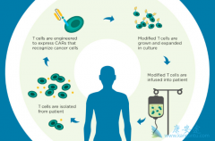 ȫ���׸�CAR-Tϸ��ҩ��Kymriah��FDA��2017��8����׼��