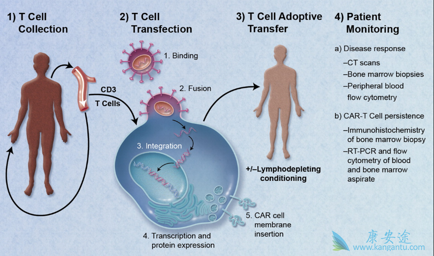 CAR-T