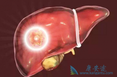 �ΰ����ڷ��ö༪���������������ô���£���Ҫͣҩ��