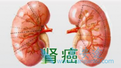 �������ڰ���ҩ������Щ����ôѡ������������Ʒ�����