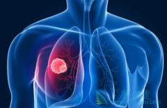 ��������(CRIZALK)�����಻����Ӧ�����Ķ�������QT�����ӳ��ۺ�֢