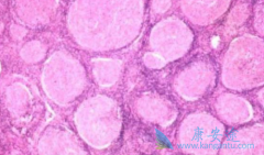 ����������/���޻����ϱ����ᵪ��ɸ���MALT�ܰ���Ԥ��