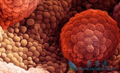 ���ð�������(ABIRATERONE)2����PSA��������˵��ҩ������Ч��