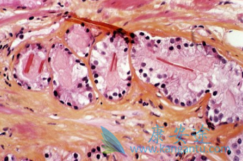 Atezolizumab