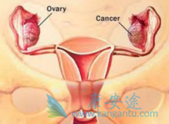 ��ŷ��PARP���Ƽ���������Ҳ���ѳ���������ҩ��