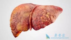 ��ɸΰ����߷�����˥�ߵ���Ҫԭ������Щ