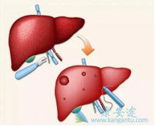 ���Ԥ�����߸���ֲ����֮���Ҹθ���