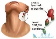 �ܰ���������֢״����Щ���ܰ����ķ�������Щ�����йأ�