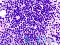 �����׵�/���ǶȰ����ϵͼ�������������������MM��Ч�ʳ�90%