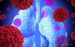 ��Щ�ΰ����߿��Է��÷ΰ�ҩ�ﰢ������(GILOTRIF)3��