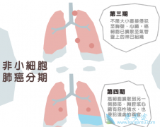 ��Щ���͵ķ�Сϸ���ΰ������ʺ�ʹ�÷��Ӱ���ҩ������