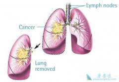 ��Сϸ���ΰ����Ӱ�������ʧ�ܺ���ʲô���Ʒ����ɹ�ѡ��