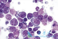 ����������(Ristova)���ϱ�׼�����ɸ��Ʋ������ܰ������ߵ�EFS��