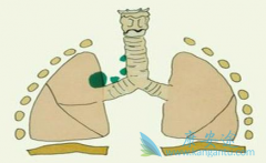 ��������(Jevtana)�ڷ�Сϸ���ΰ������б��ֳ��˿���������