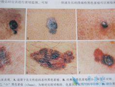 ��ɫ�صķ��ڲ�ͬ������ʹ�õ����Ʒ�����ͬ