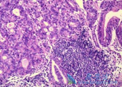 ��ɳ����(Oxaliplatin)�ܷ����ϻ�������ƽ�չ��θ��