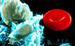 ��ɳ����(Dasatinib)�ɴ���Ѫ������Ԥ��������ϵͳ��Ѫ��