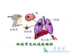 �����ΰ���ת�ƵĻ���������Ӧ��ע��Щʲô