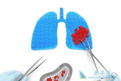 �ٴ���ѡ��ΰ����Ʒ���֮ǰ��Ҫ������Щ����