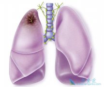 ȫ�����ƶԷΰ���ת��Ч������ʱ����ʲô�����ɹ�ѡ��