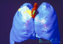 ��������(Afatinib)���һ���ΰ�ҩ����Ϊ���ߴ���������������