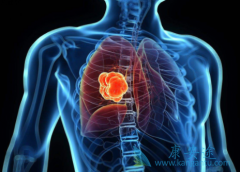 ΪʲôEGFR���Ƽ��Բ��ַΰ��ٰ�������Ч�����绯�ƺ�