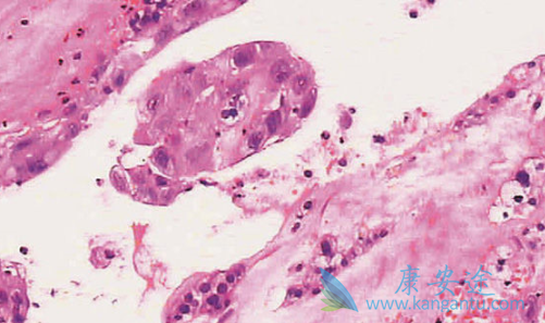 ������Ƥ�ʰ�