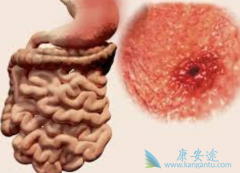 �����������ỹ����Щ����θ������������ҩ��