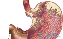 ��췢�ֵ������������˾���ô����