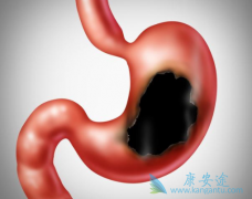 ���������˾���Σ������Щ�����������Ԥ����