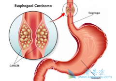 �ٴ�������ЩPD-1���������ʳ�ܰ�����